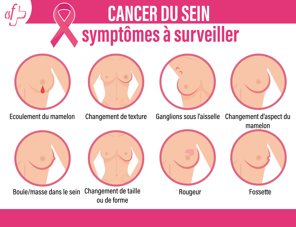 Types de cancer du sein 